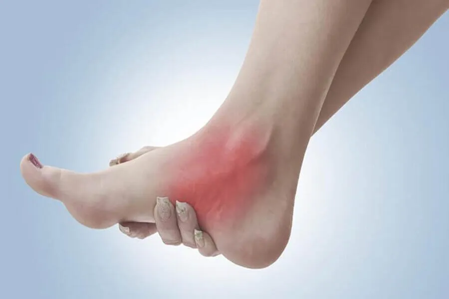 5 Dấu hiệu gout nhẹ mà người bệnh có thể phát hiện sớm