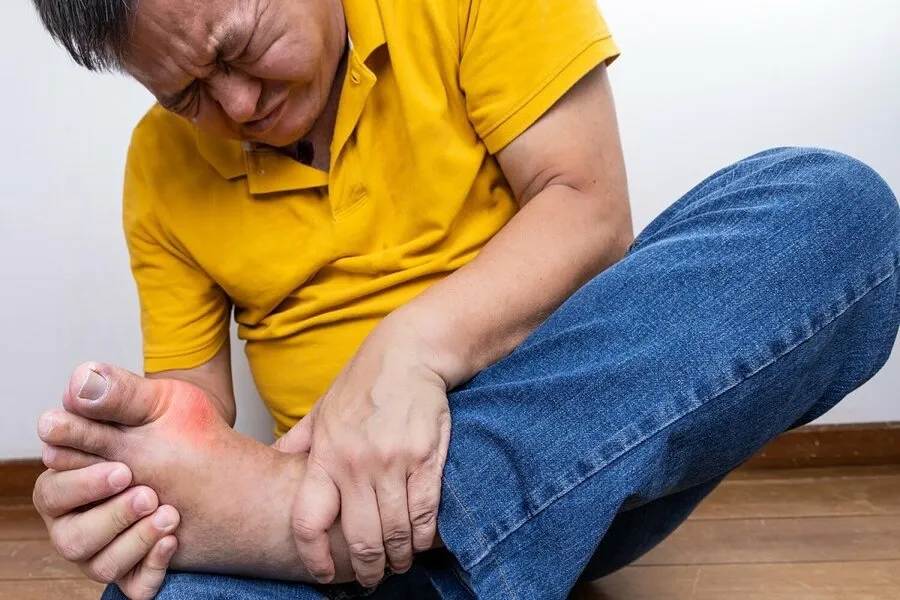 Bệnh gout có nguy hiểm không? Những biến chứng nguy hiểm