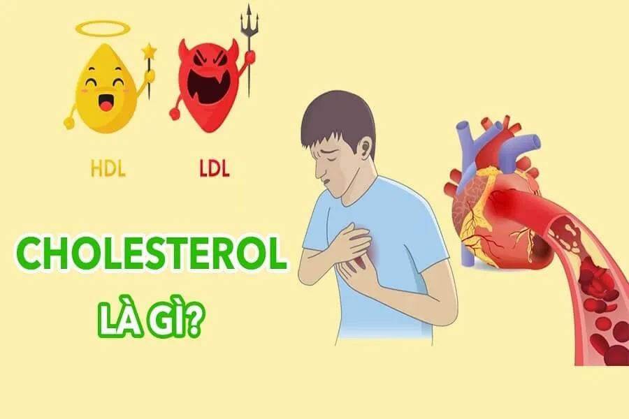 Cholesterol là gì? Những điều cần biết về cholesterol