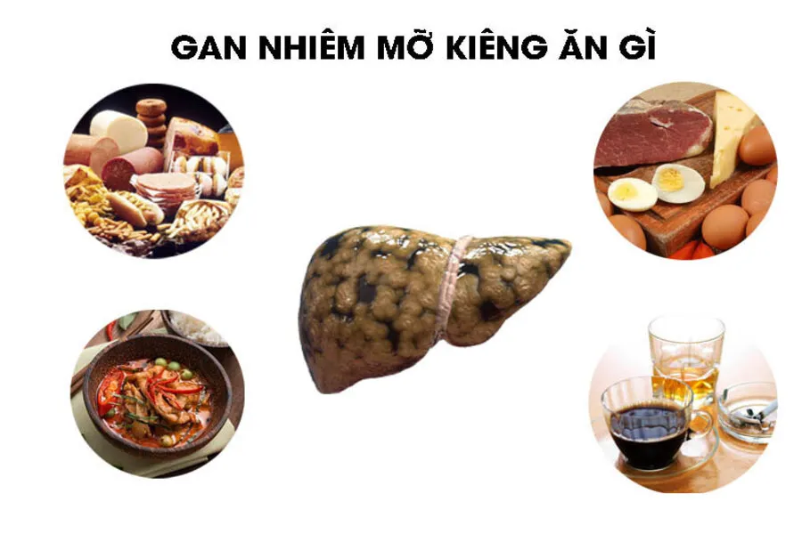 Gan nhiễm mỡ kiêng ăn gì để không gây hại cho gan?