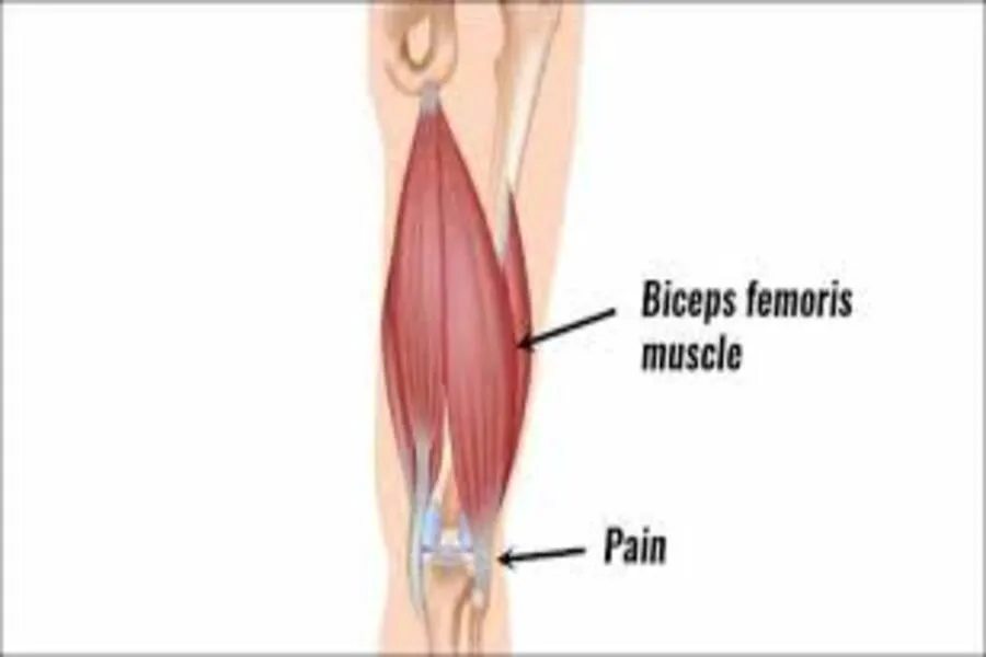 Giải đáp Hamstring là gì? Các bài tập cải thiện cơ Hamstring