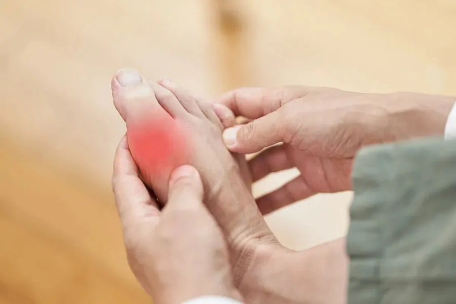 Người mắc bệnh gout có chữa được không?