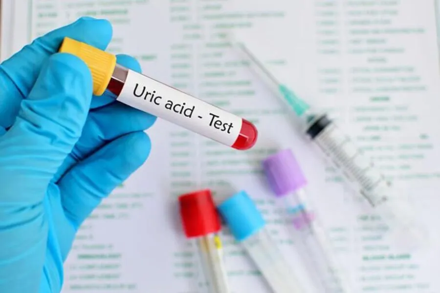 Những cách đào thải acid uric nhanh sau 7 ngày