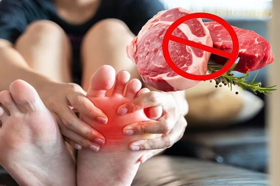 Những dấu hiệu bệnh gout qua các giai đoạn và mức độ nguy hiểm